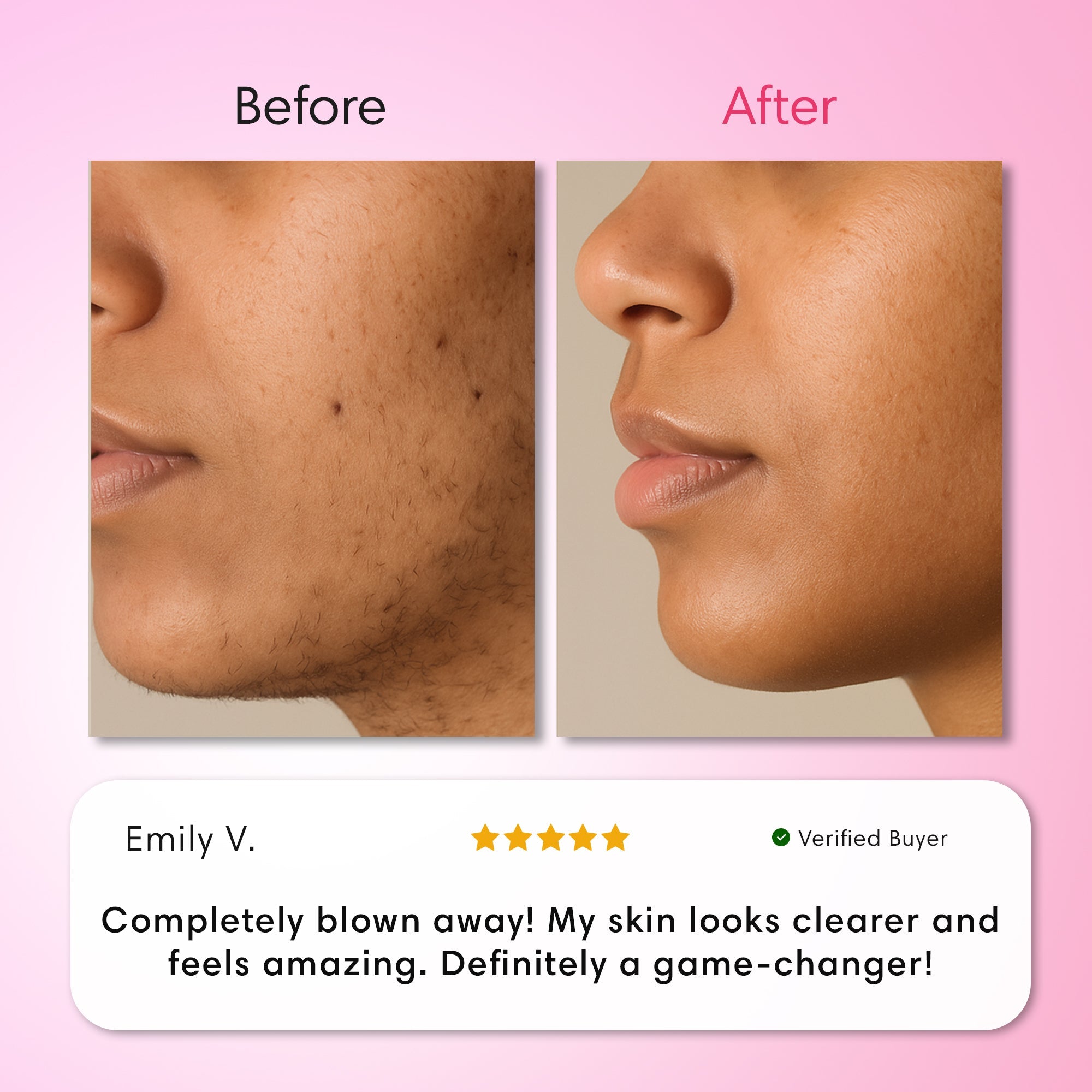 Hair Removal Trilogy Kit